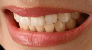 Krzywe akcje przy prostowaniu zębów. Dr Smile z zarzutami